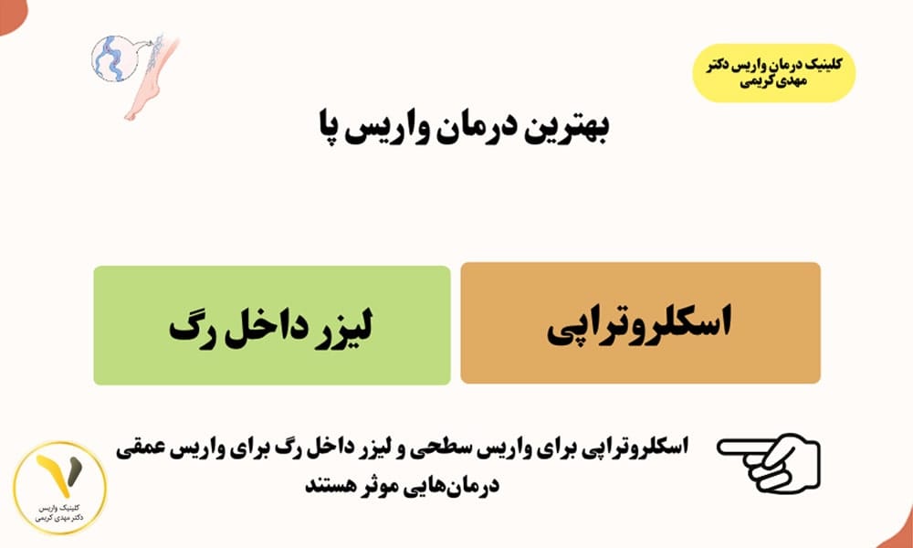 بهترین درمان واریس پا