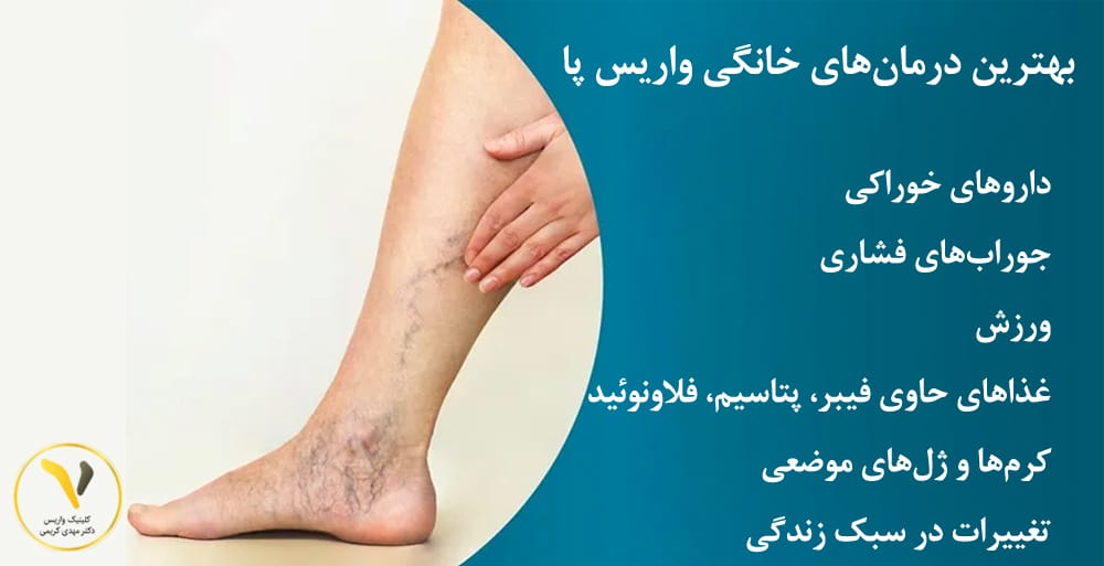 بهترین درمان واریس پا