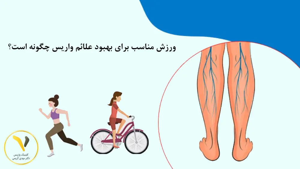 ورزش مناسب واریس