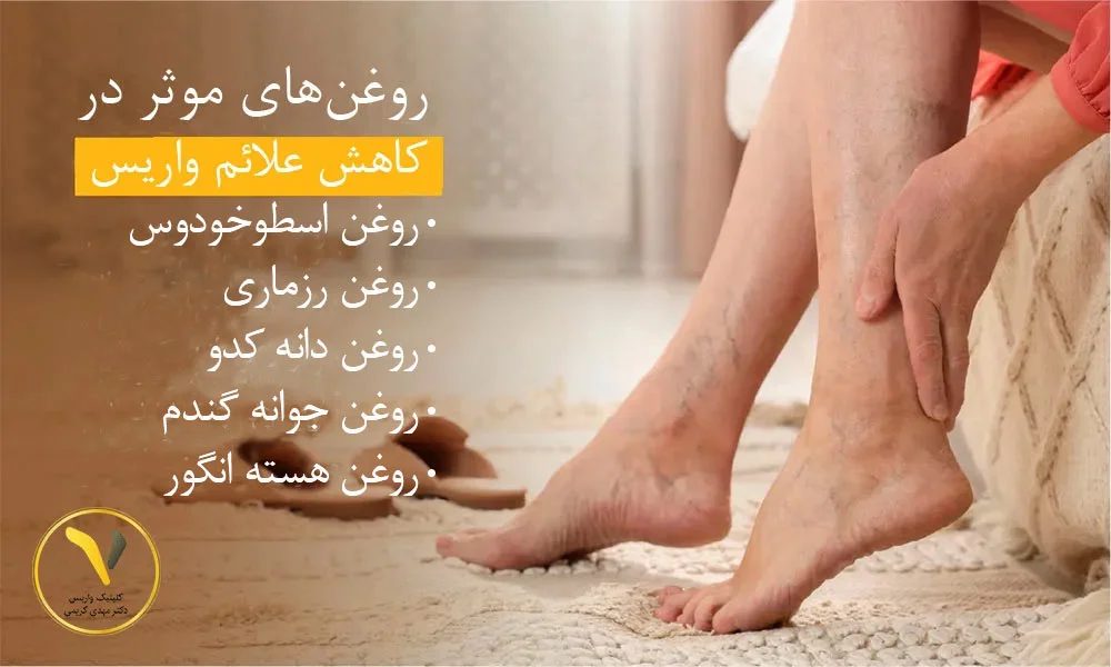 روغن برای درمان واریس