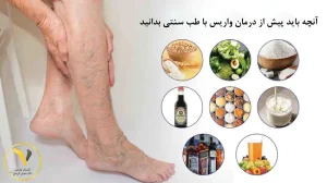 درمان واریس با طب سنتی