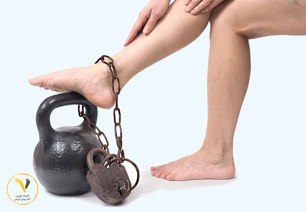 سنگینی و خستگی